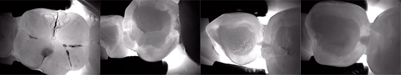 DIAGNOcam telecamera digitale acquisisce l’immagine e la trasferisce immediatamente allo schermo