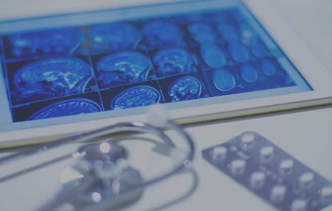 Consulenza neurologica